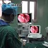Medical full HD endoscopy camera to Mauritius market
