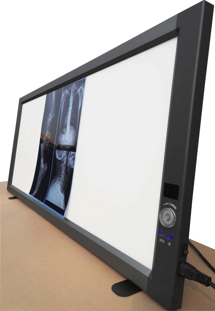 Super thin Quadruple LED x ray film viewing box negatoscope
