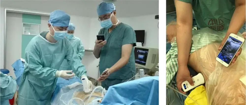 Doppler ultrasound Transducer USG small ultrasonic transducer wireless ultrasound Probe Machine