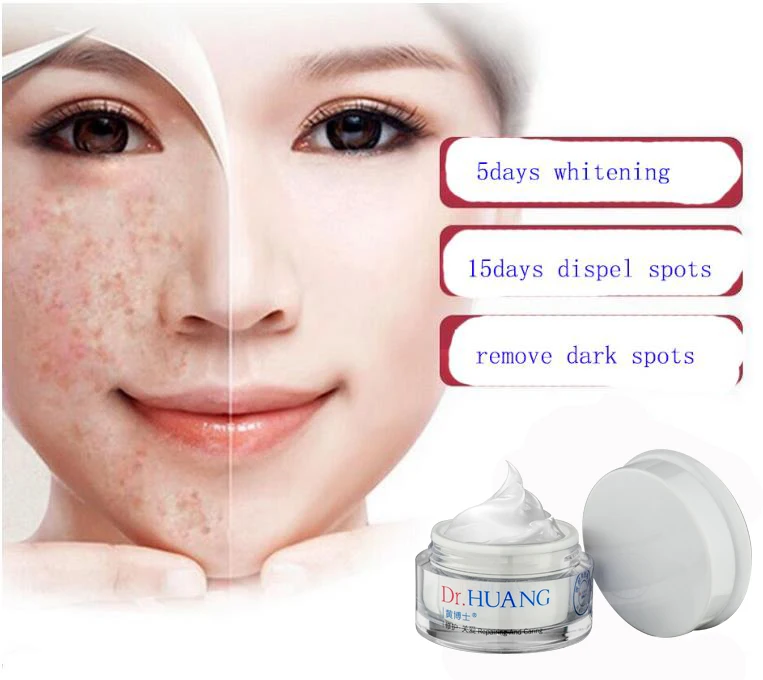 Anti Freckle Removal Face Dark Spot Due Whitening Cream In Sri Lanka ...