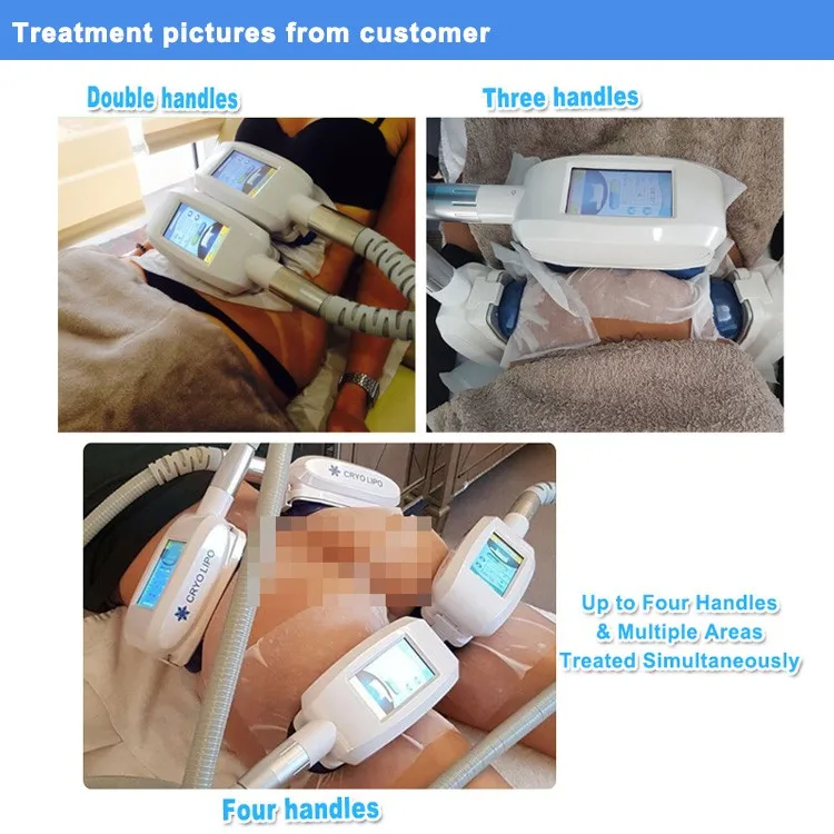 360 Degree Surrounding Lipo Cryo Fat Freezing Cryolipolysis Slimming