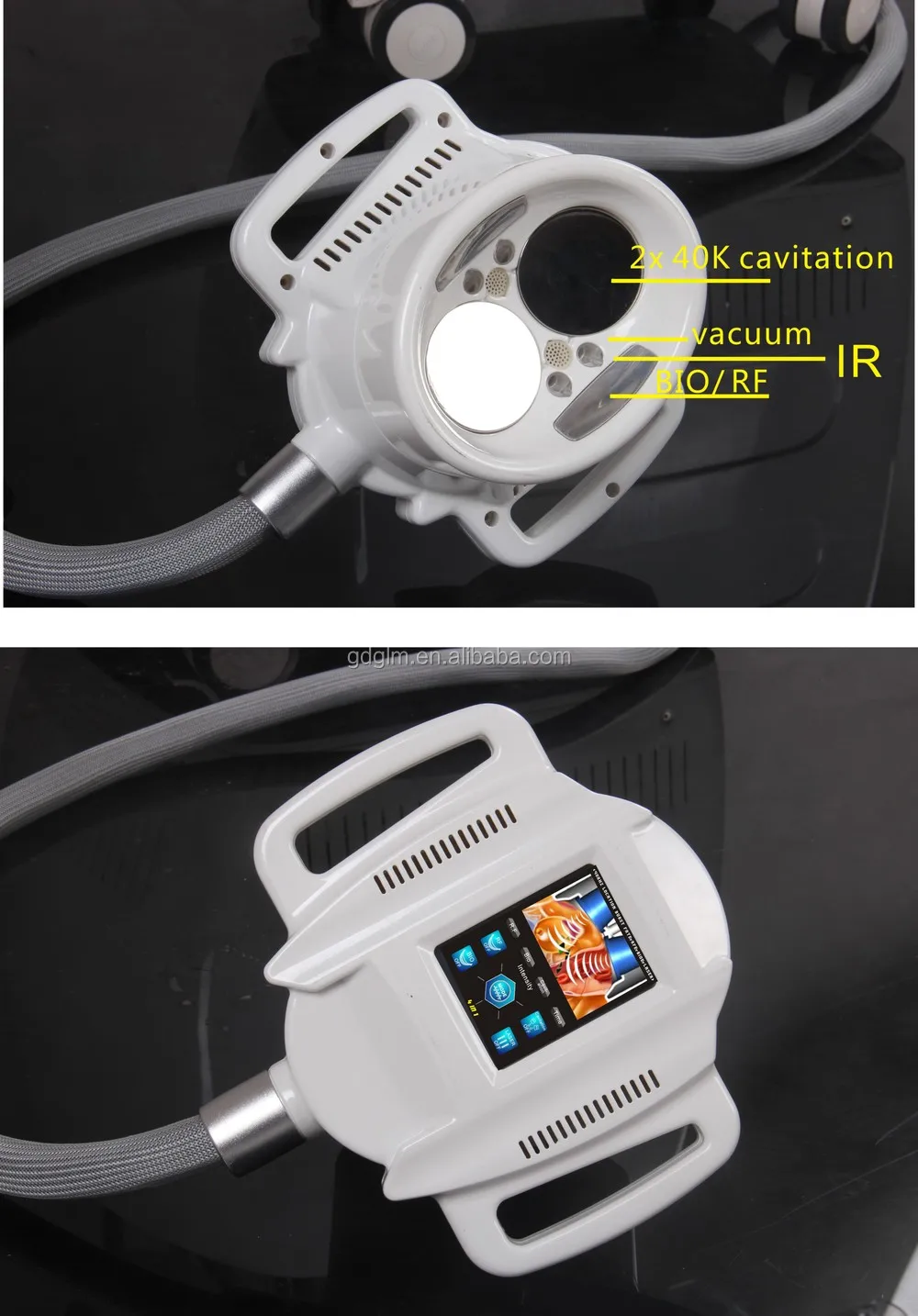 velashape after smart lipo