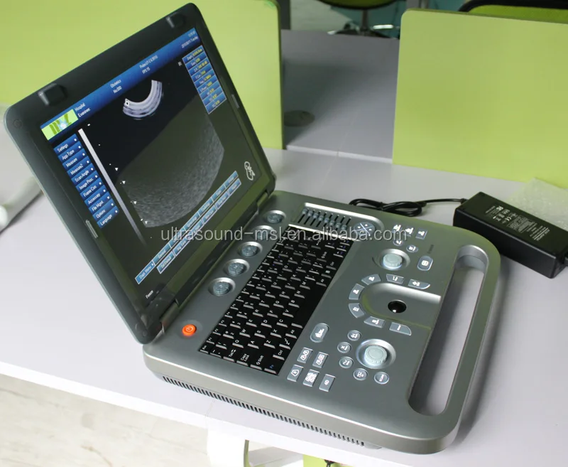 3d/4d Portable Ultrasound System /pregnancy Test Ultrasound Machine