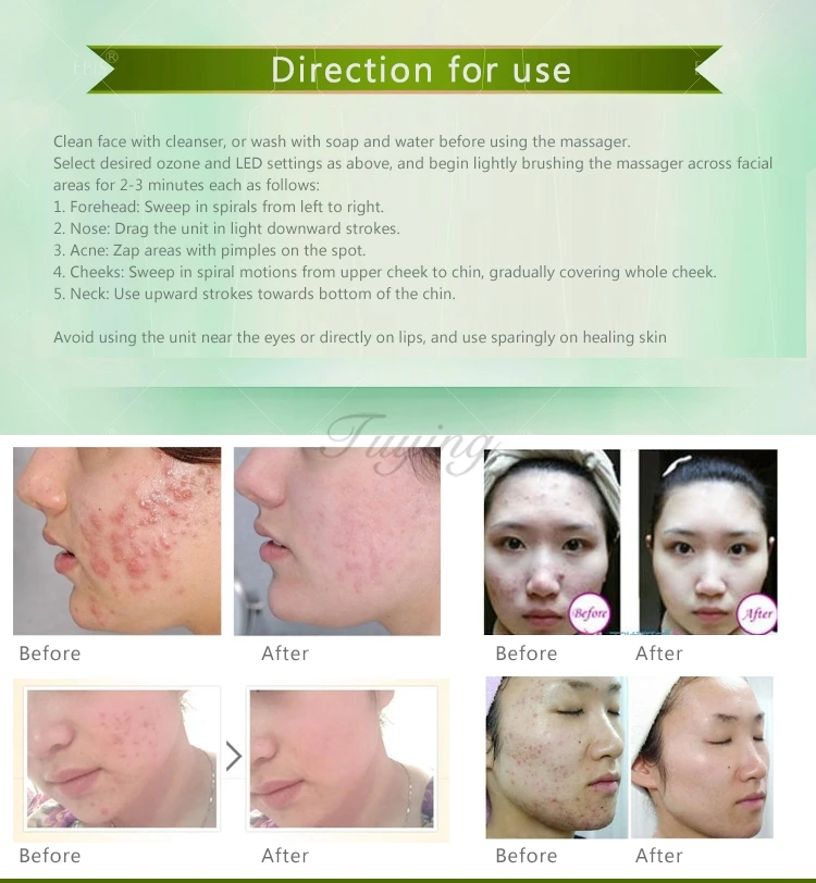 Mini O3 ozone Therapy Machine Facial Massager Beauty Therapy Equipment for skin tightening