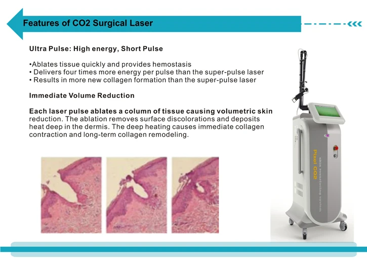 co2 lasers for vaginal surgery American shorthorn ass