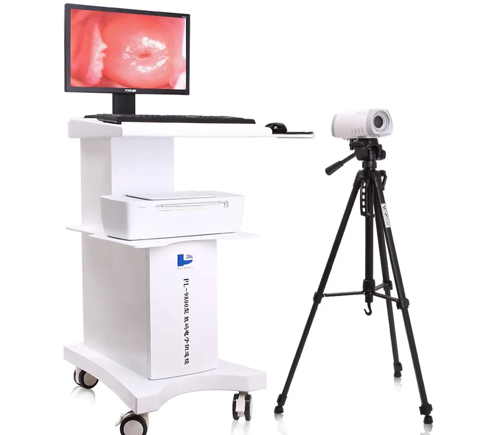Digital Imaging System Beautiful Vagina Colposcope Camera For Vagina
