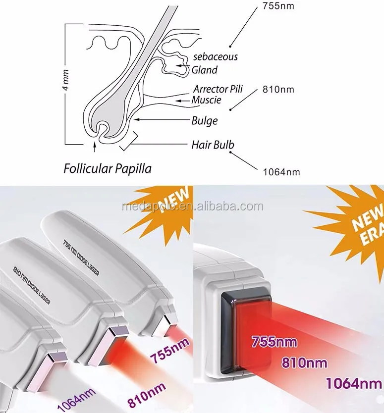 3 wavelength diode laser hair removal equipment with TUV CE0197 medical approved
