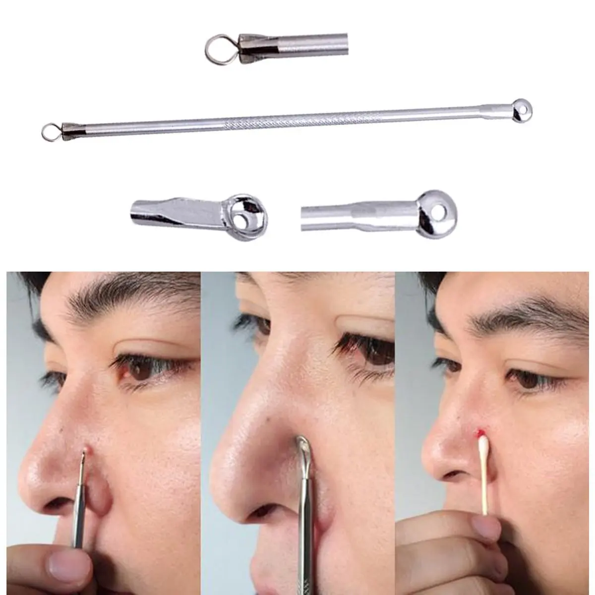 Как называется выдавливание прыщей. Экстрактор для очищения пор Tweezerman Blackhead Extractor. Петелька для выдавливания прыщей. Ложечка для выдавливания угрей.