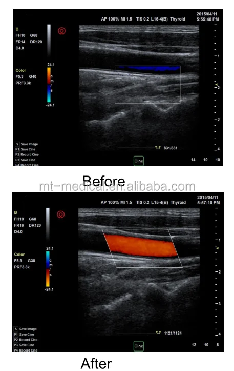 Portable Ultrasonic Diagnostic Devices Type Ultrasound Machine For Pregnancy