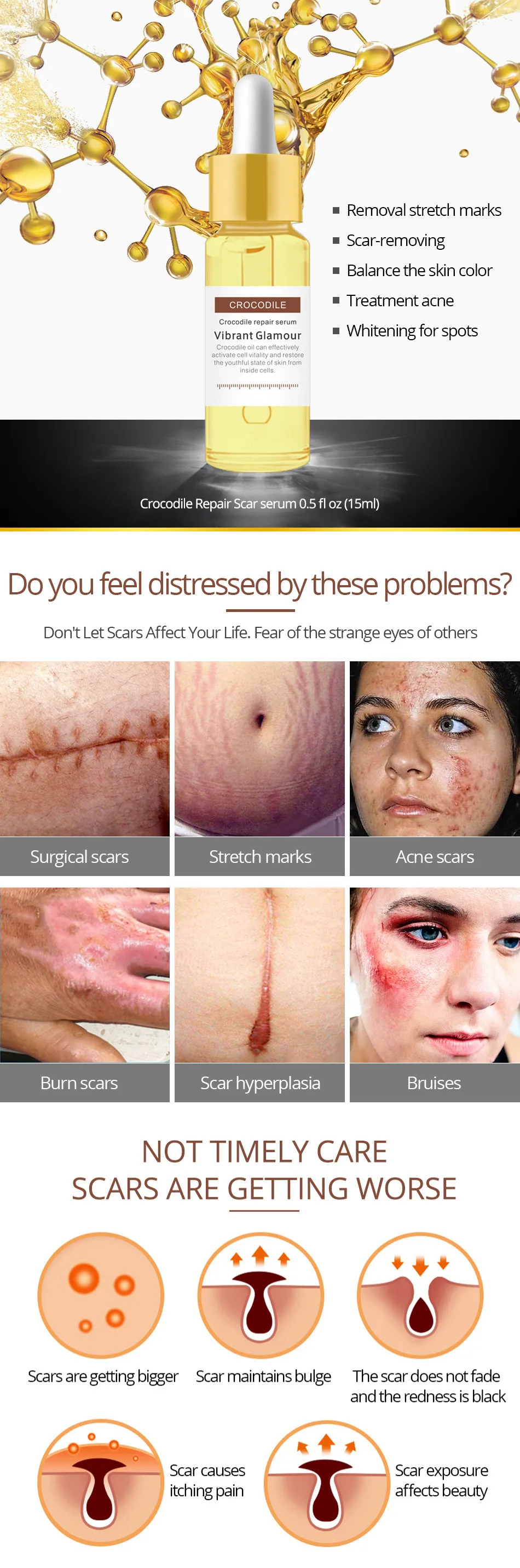 crocodile oil for stretch marks