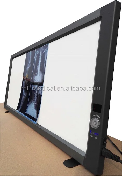 Most New models of ultrathin LED x-ray film viewer for public use and special for hospital