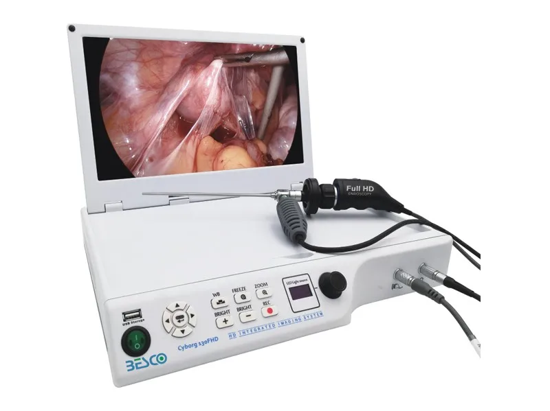 Medical Full Hd Portable Intergrated Endoscopic Imaging System - Buy ...