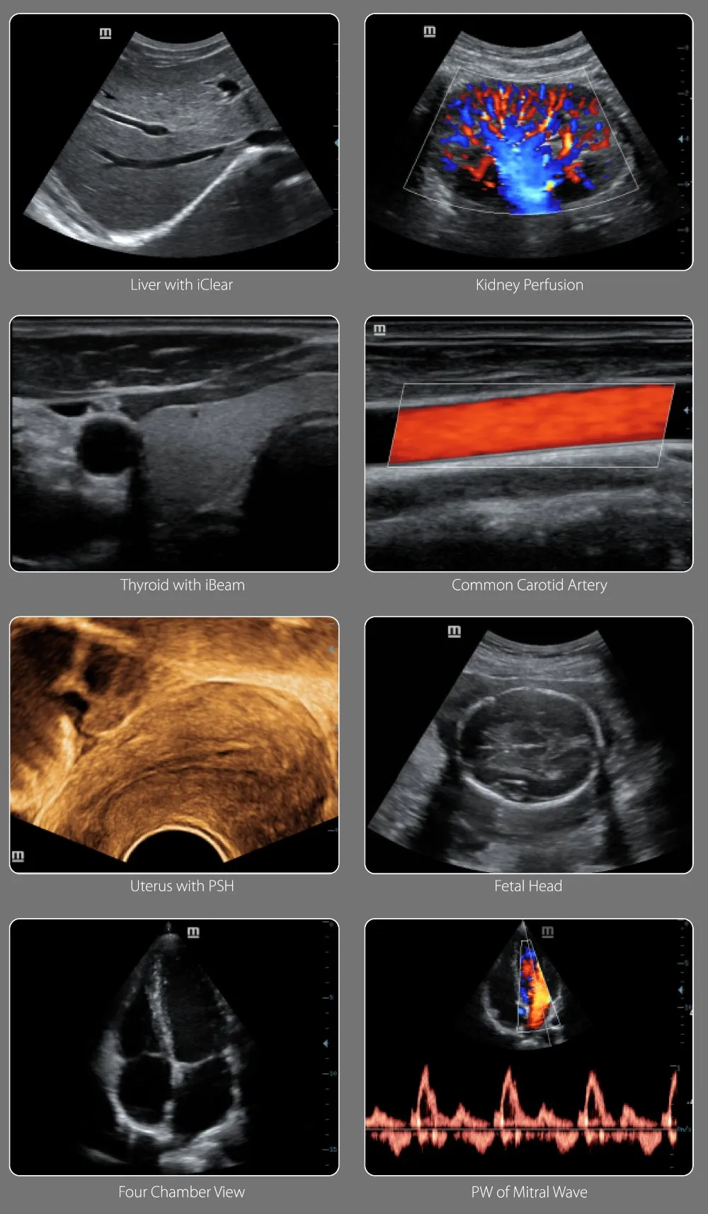 Mindray Dc-26 Medical Ultrasound Instruments 3d/4d Trolley Color ...