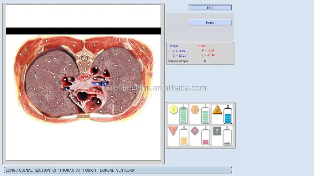 New Product Bioplasm 9d Nls Bdoy Health Analyzer