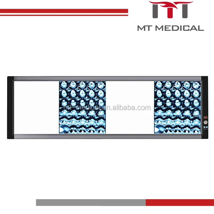 High quality LED X-ray viewer box for medical use, made in China