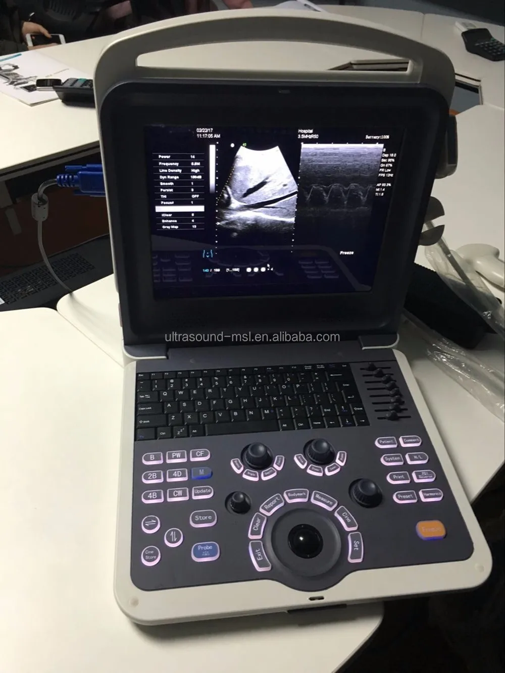 Cardiac Cw Medical Portable Echocardiography Color Doppler 4d