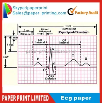 Ecg Chart Paper Sample