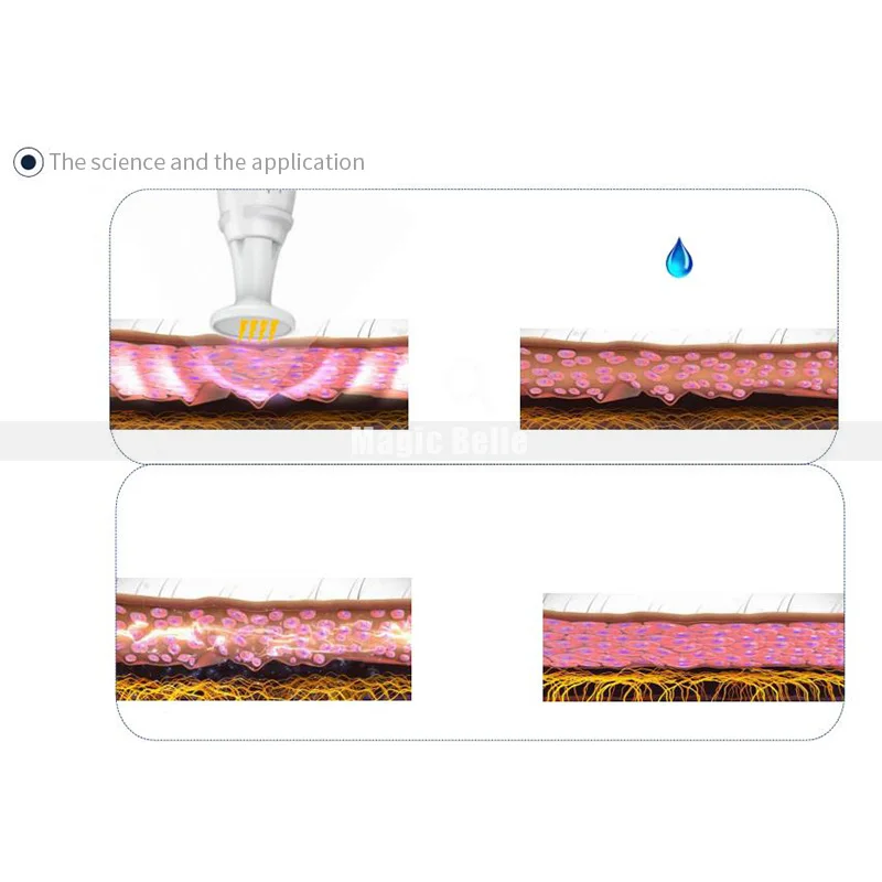 Plasma jett 2 in 1 MA (16)