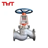 Excellent quality stainless steel oxygen globe valve