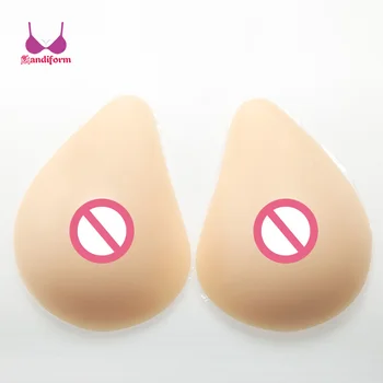 Breast prosthesis stores local picture