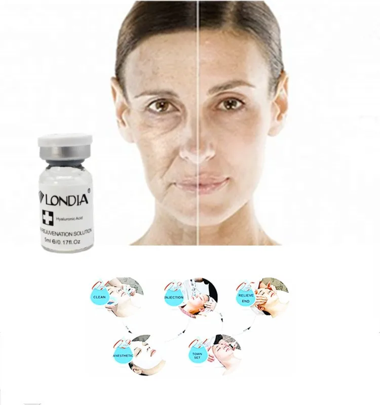 2ml Cross Linked Sodium Hyaluronic Acid Injection Radio Frequency Skin