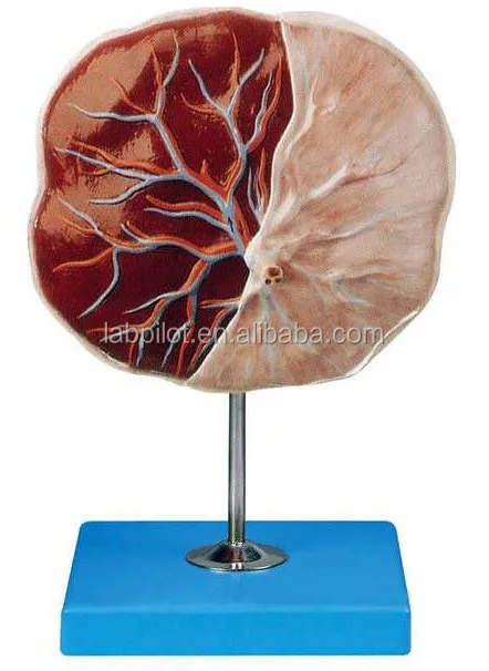 A42010-1 placenta model (7).jpg