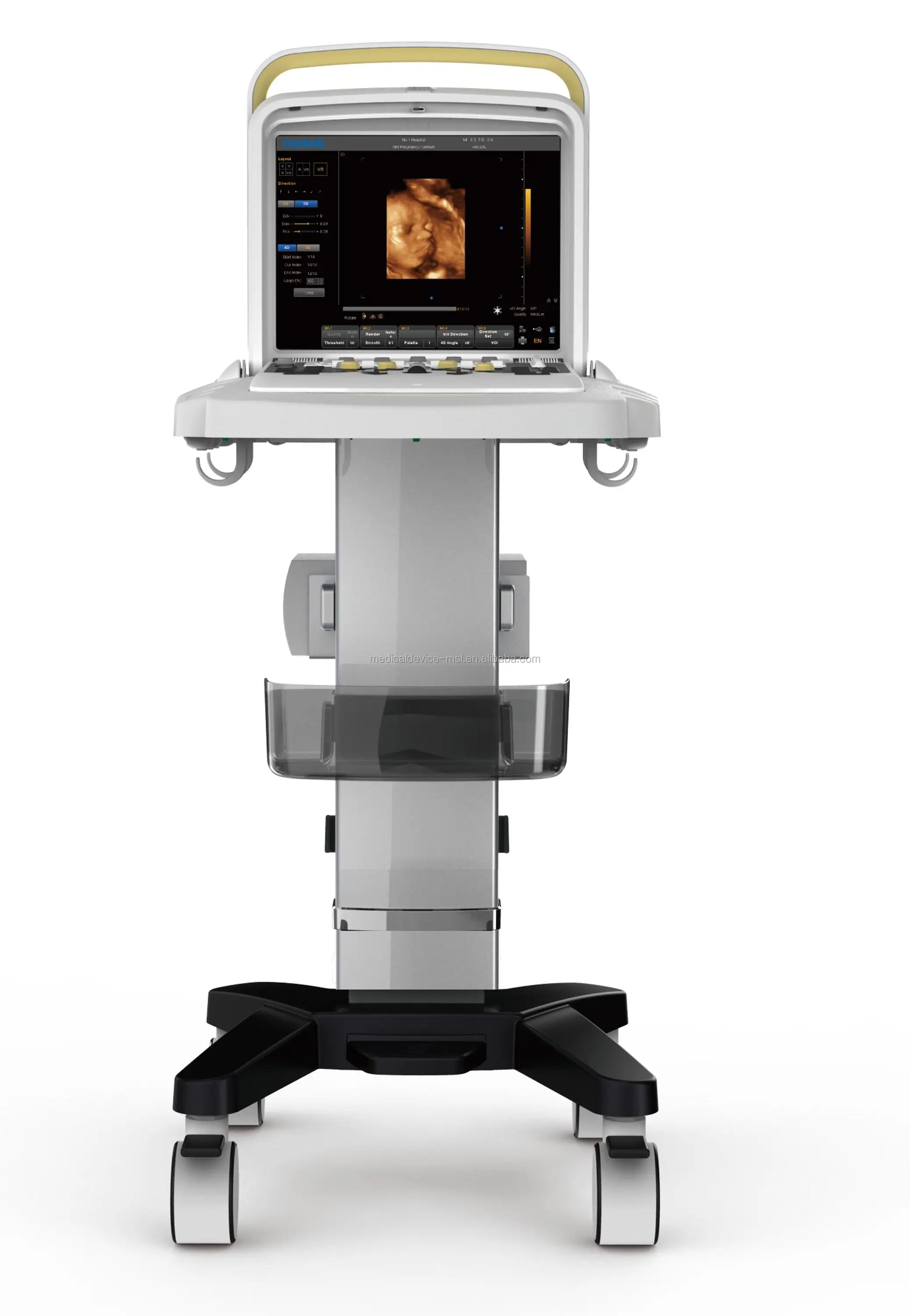 Cost-effective Price Diagnostic Chison Q5 Portable Color Ultrasound 