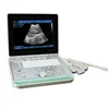 MCB-SS-9 Laptop Fully Digital Ultrasound Scanner