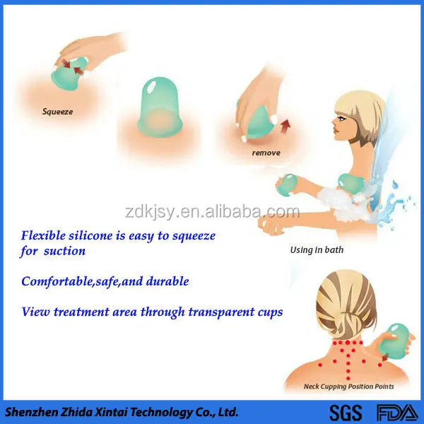 Cupping Deutsch Cupping Deutsch