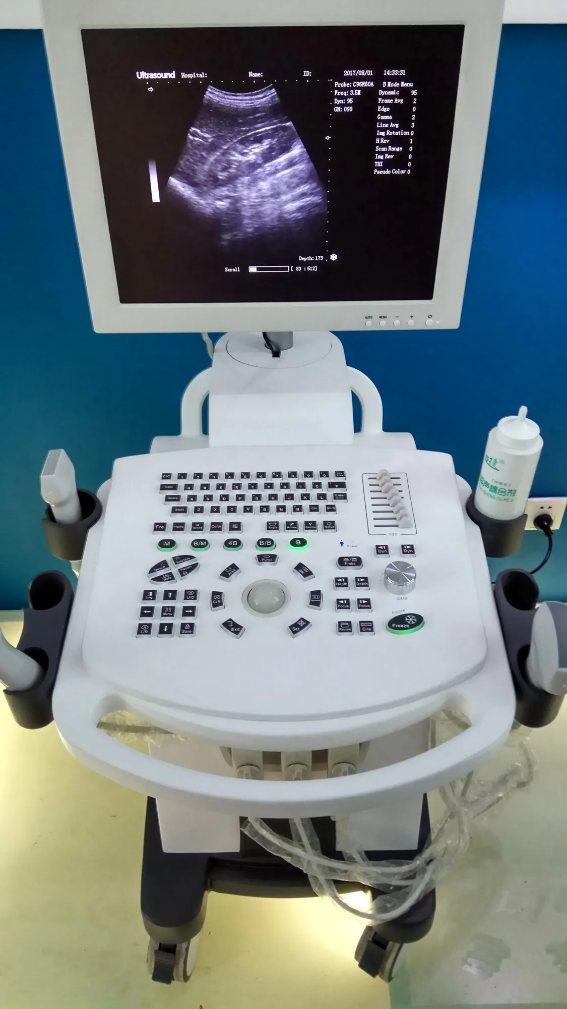 Thr-us370 B/w Professional Digital Ultrasound Scanner Trolley Type
