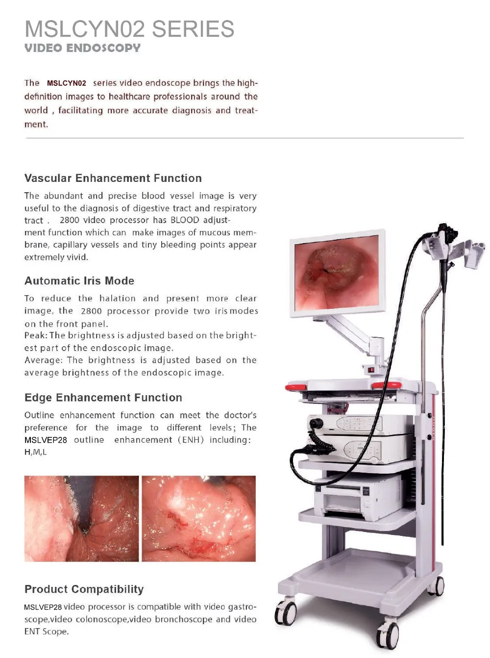 High Definition Image Medical Video Endoscope Cheapest Endoscopy