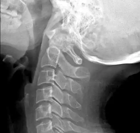 xray of gay sex act gay browse alexa