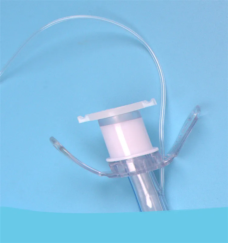 来自制造商的高品质 negus 气管造瘘管