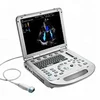 Mindray M7 premium best ultrasound for cardiovascular portable echo ultrasound machine