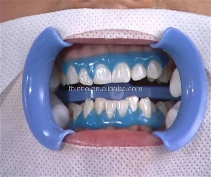 Gingival Protection Gel For Teeth Whitening Buy Teeth Gum Protection