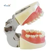 High Quality Artificial Physician Certified Tooth Extraction Model of Teeth