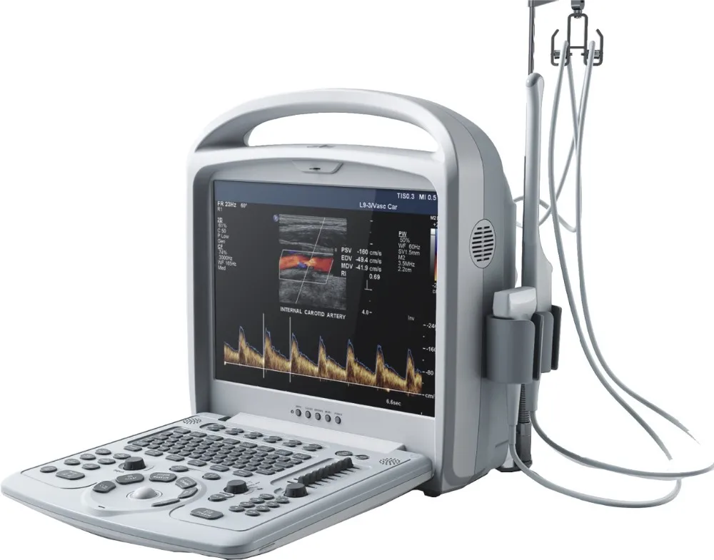 Portable Color doppler ultrasound scanner WT-9200B laptop model