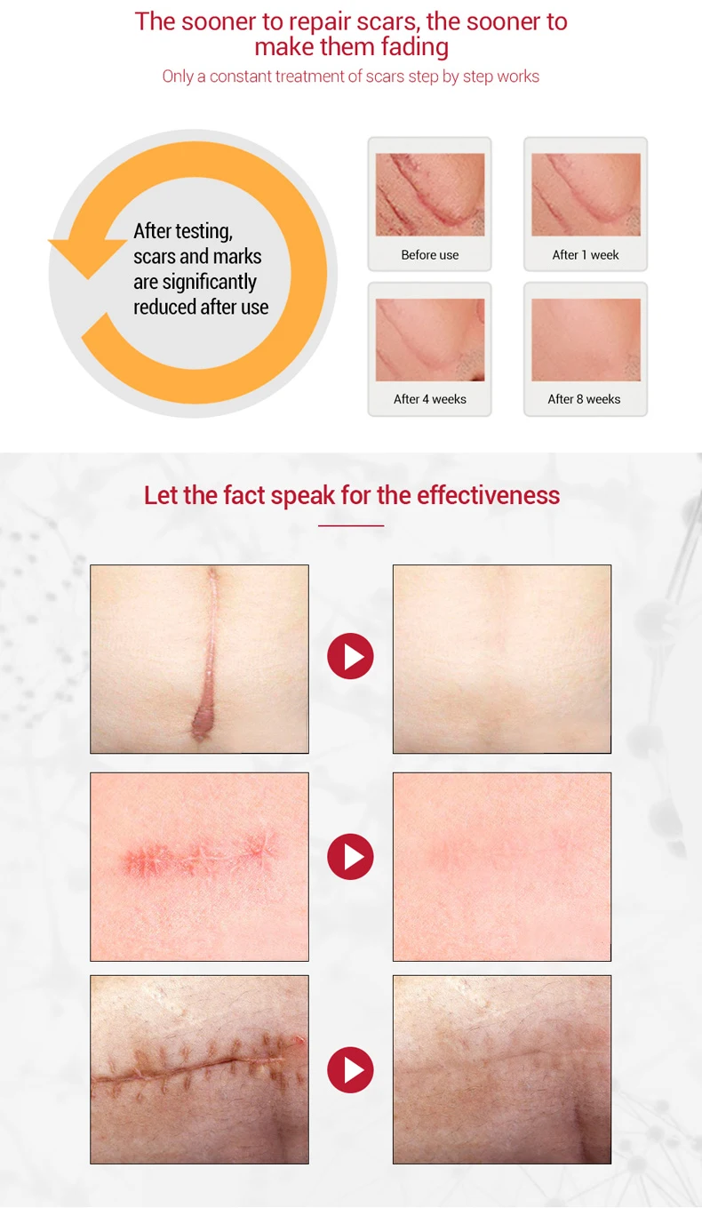 Skin Care Dark Spot Repair Gel Face Pimples Acne Scar Mark Removal Cream For Acne