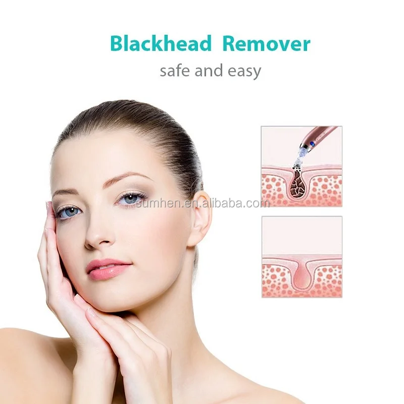 face clean blackhead remover
