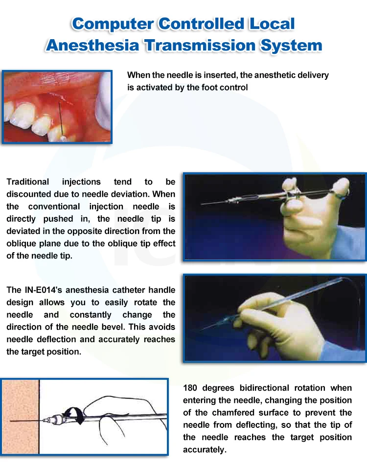 Dental Anesthesia Equipment