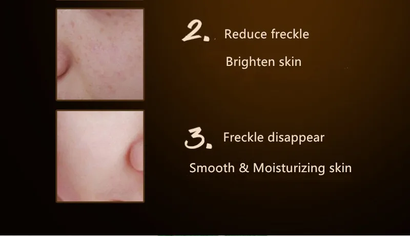 2019  best whitening cream for face anti-spot Freckle whitening cream to remove the dark yellow melanin spot face cream unisex
