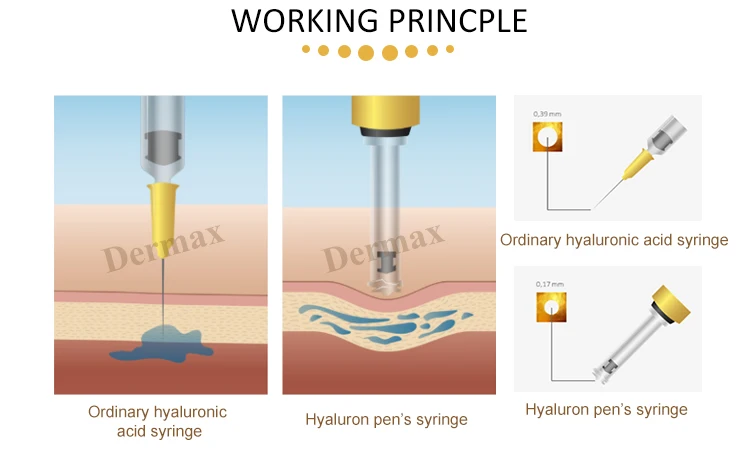 luxury 3&5 ml hyaluronic acid dermal filler serum needle-free injector pen