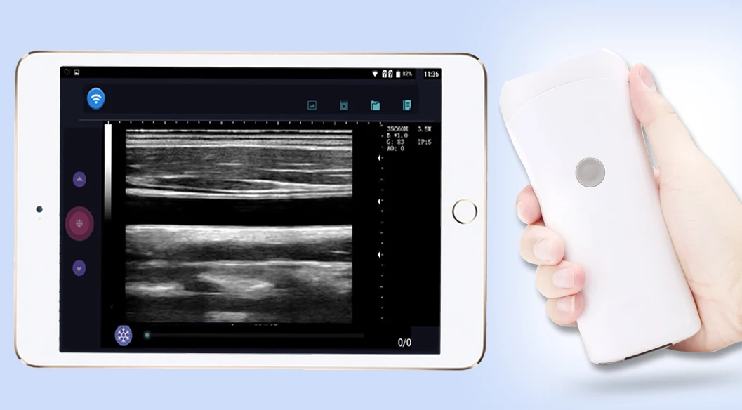 Probe typewirelesscheap factory portableultrasoundmachinefor pregnancy
