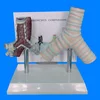 Demonstration model comparing trachea of healthy and smoking people