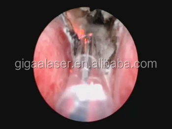 urologo prostata allargata