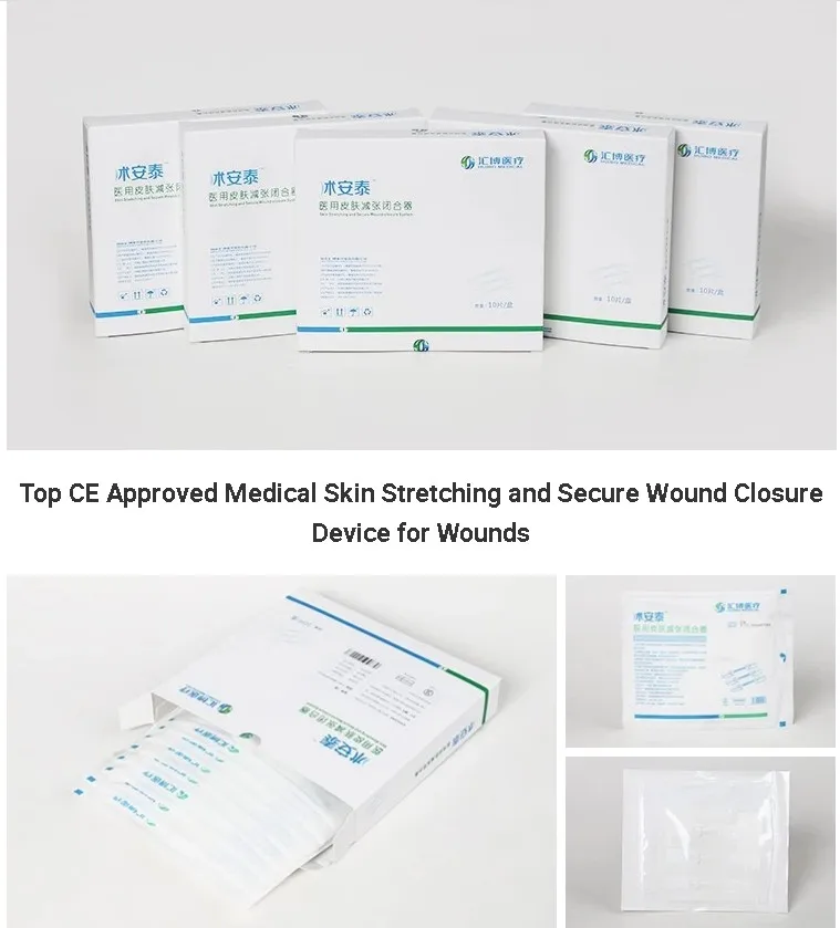 Fda Ce Iso13485 Skin Wound Closure Device - Buy Suture Adn Staple Free ...