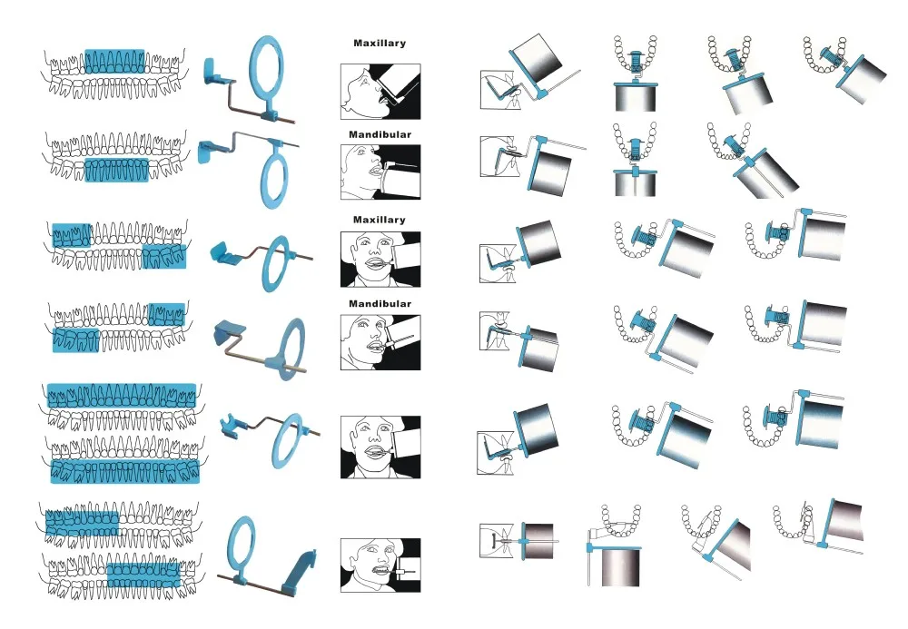 X Ray Positioning Chart Free Download