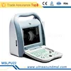 Full digital portable ophthalmic A/B ultrasound scanner/ ultrasound machine MSLPU22E