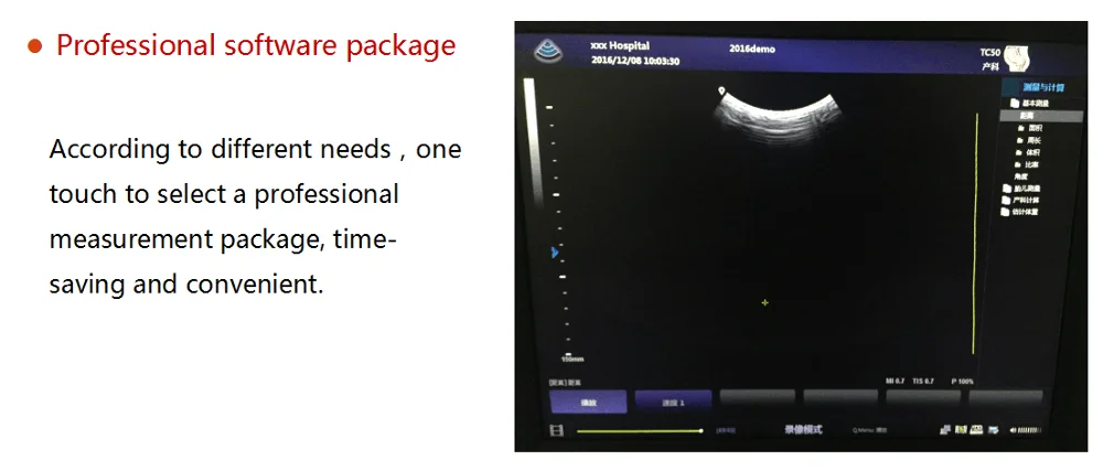 Ultrasonic USG ultrasound Scanner portable ultrasound usg