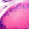 Hyaline cartilage of Human sec. HE staining methods histology prepared microscope slides sets